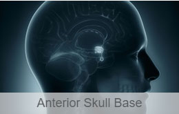 Anterior skull base surgery